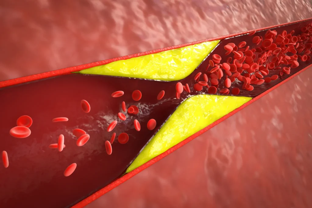 wysoki cholesterol zwal echo serca warszawa