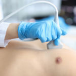 EKG A CHOROBA ZASTAWEK WARSZAW